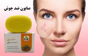 چه صابونی برای جوش و جای جوش خوبه