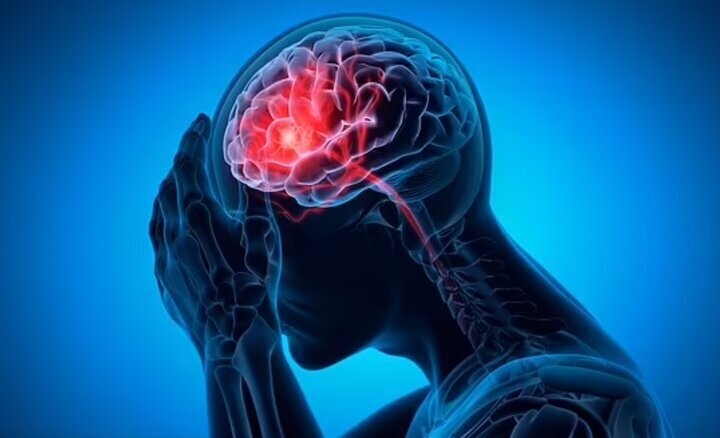 چه کسانی بیشتر در معرض خطر سکته مغزی هستند؟