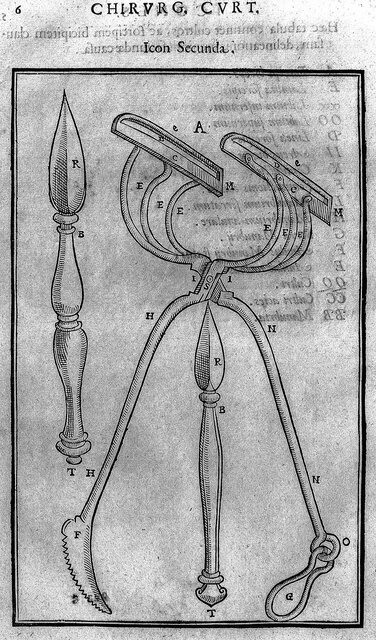 جراحی تاریخچه عمل های زیبایی/ اولین جراحی زیبایی تاریخ کِی انجام شد؟
