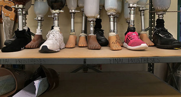 شناخت انواع پروتز پا