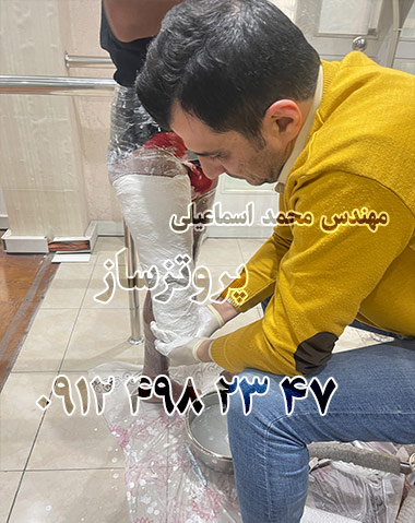 شناخت انواع پروتز پا