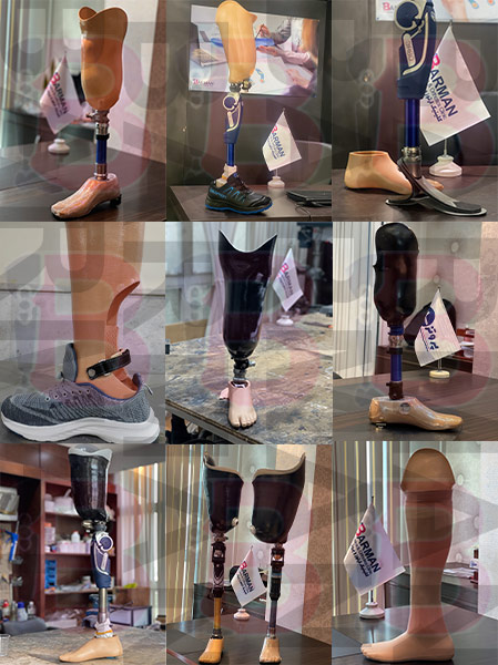 شناخت انواع پروتز پا